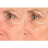 SiO SuperLift Wrinkle Smoothing Pack, 4 CT, thumbnail image