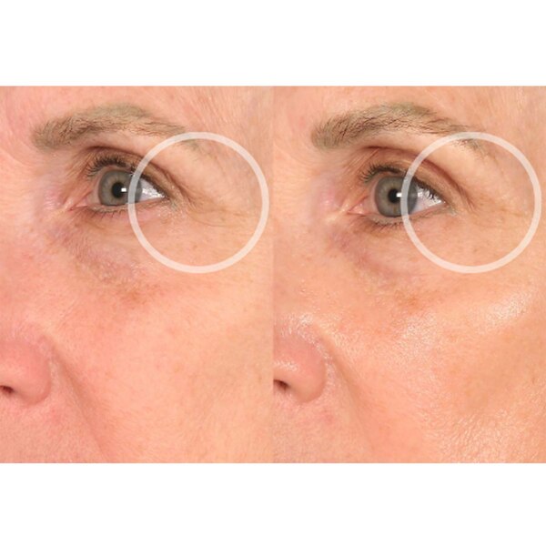 SiO SuperLift Wrinkle Smoothing Pack, 4 CT