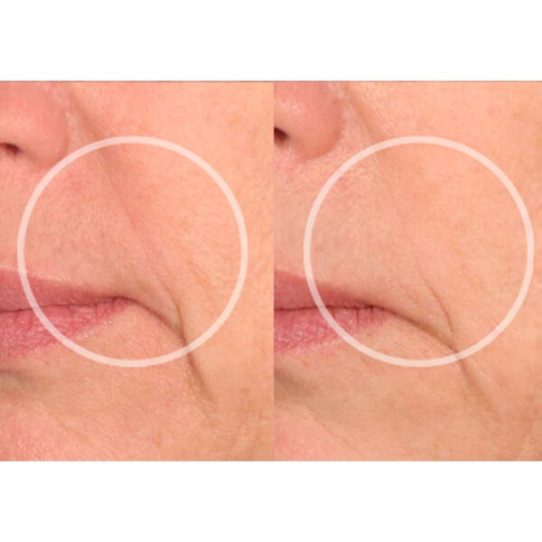 SiO SuperLift Wrinkle Smoothing Pack, 4 CT