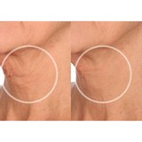 SiO FaceLift Wrinkle Smoothing Pack, 4 CT, thumbnail image