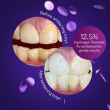 Burst Prefilled Whitening Trays, 3 Treatments, thumbnail image
