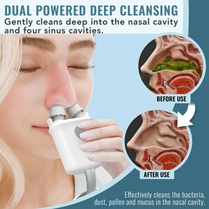 NasalFresh MD Dual Powered Nasal Irrigation System +30 CT Saline Packets
