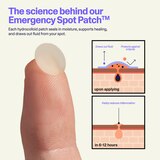 Curology Emergency Spot Patches, 40 CT, thumbnail image