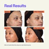 Curology Dark Spot Serum, 1 OZ, thumbnail image 4 of 6