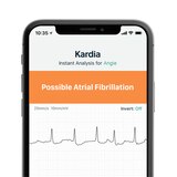 AliveCor KardiaMobile Personal EKG Monitor, thumbnail image