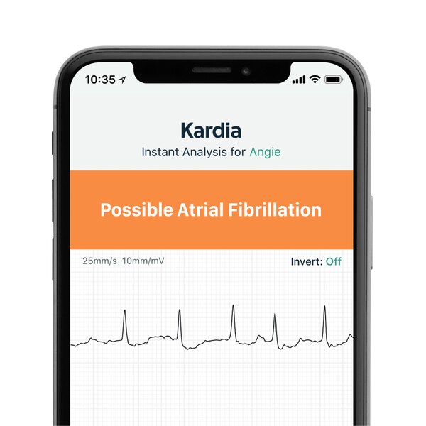 AliveCor KardiaMobile Personal EKG Monitor