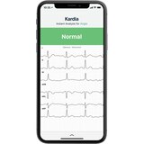 AliveCor KardiaMobile 6L Personal EKG Monitor, thumbnail image
