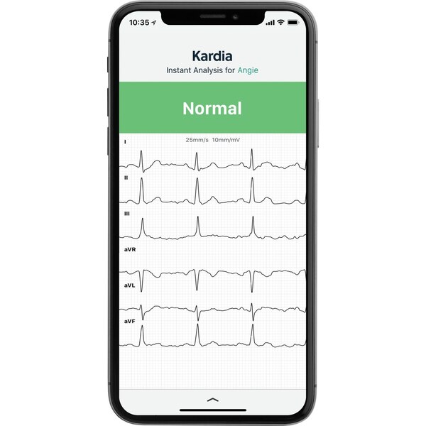 AliveCor KardiaMobile 6L Personal EKG Monitor