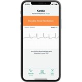 AliveCor KardiaMobile 6L Personal EKG Monitor, thumbnail image