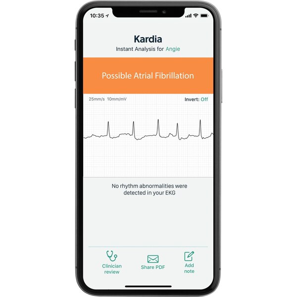 AliveCor KardiaMobile 6L Personal EKG Monitor