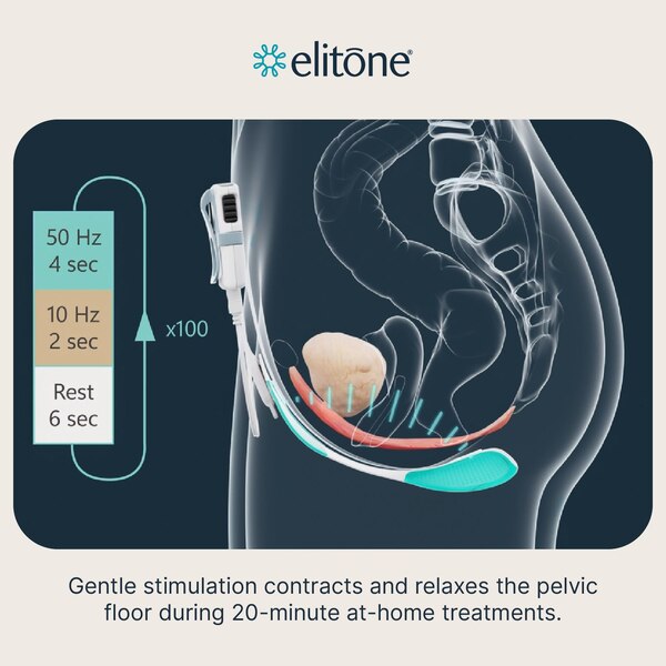 ELITONE Pelvic Floor Incontinence Treatment Kit