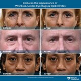 Plexaderm Rapid Reduction Serum, 18CT, thumbnail image