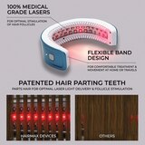 HairMax LaserBand 41 ComfortFlex Device for Hair Regrowth, thumbnail image