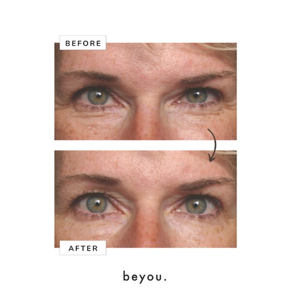 Beyou 10-Second Wrinkle Eraser Eye Cream, 0.5 oz