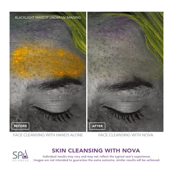Spa Sciences NOVA Antimicrobial Sonic Cleansing System