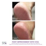 Spa Sciences VIVA Advanced Pedicure Foot Smoothing System, thumbnail image