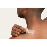 Hero Cosmetics Mighty Patch Surface Acne Patch, 10CT, thumbnail image