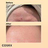 Cosrx Advanced Snail 96 Mucin Power Essence, 3.38 oz, thumbnail image