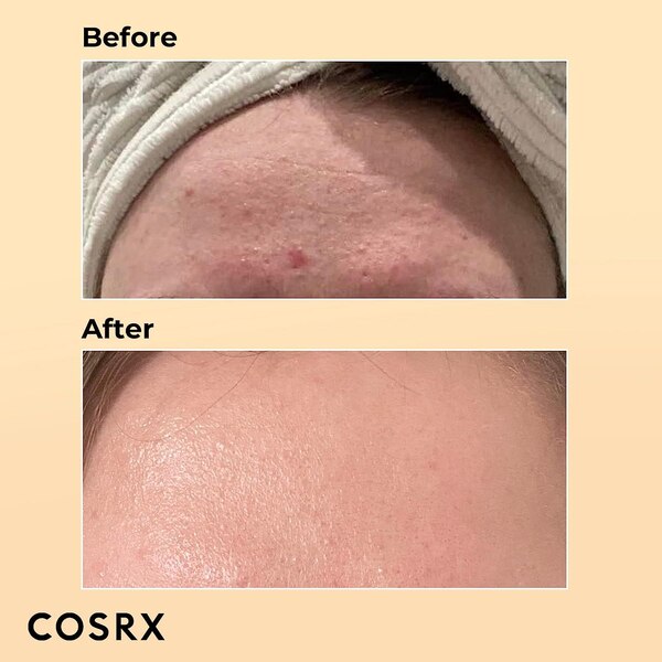 Cosrx Advanced Snail 96 Mucin Power Essence, 3.38 oz