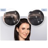 Keranique Rejuvenate Deep Hydration Complete Hair Regrowth System, thumbnail image