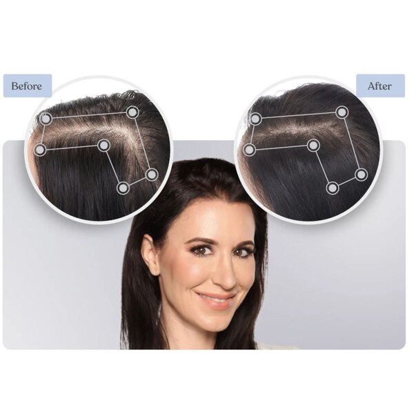 Keranique Rejuvenate Deep Hydration Complete Hair Regrowth System