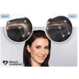 Keranique Hair Regrowth System, thumbnail image
