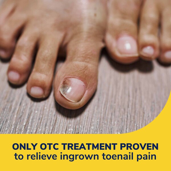 Dr. Scholl's Ingrown Toenail Pain Reliever, 0.3 OZ