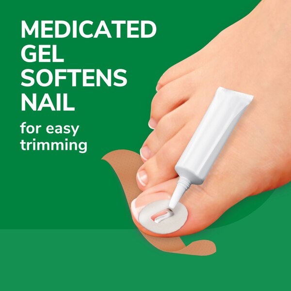 Dr. Scholl's Ingrown Toenail Pain Reliever, 0.3 OZ
