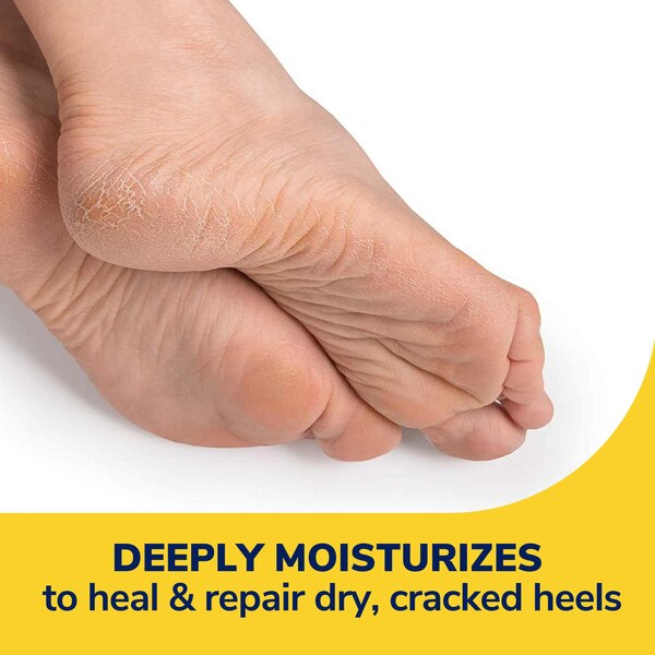 Dr. Scholl's Severe Cracked Heel Balm, 2.5 OZ