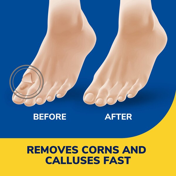 Dr. Scholl's Liquid Corn and Callus Remover