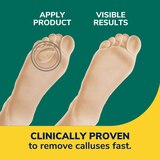 Dr. Scholl's Duragel Callus Remover, thumbnail image