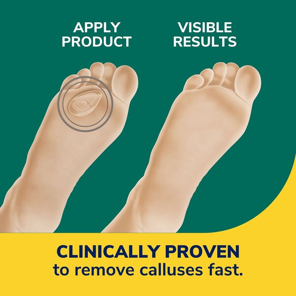 Dr. Scholl's Duragel Callus Remover