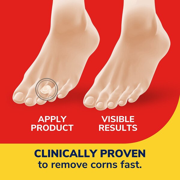 Dr. Scholl's Duragel Corn Remover