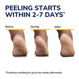 Dr. Scholl's Ultra Exfoliating Foot Mask, 1 pair, thumbnail image
