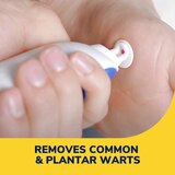 Dr. Scholl's Freeze Away Max Plantar Wart Remover, 10 CT, thumbnail image