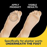 Dr. Scholl's Plantar Wart Remover Hydrogel Bandage, 12 CT, thumbnail image