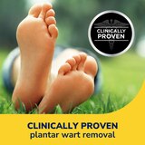 Dr. Scholl's Liquid Plantar War Remover, 1.3OZ, thumbnail image