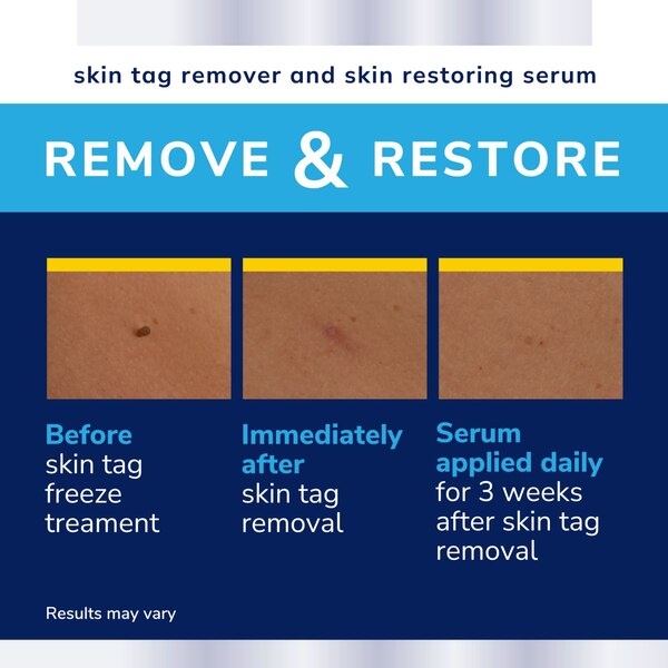 Dr. Scholl's Skin Tag Complete Care Remove & Restore Kit