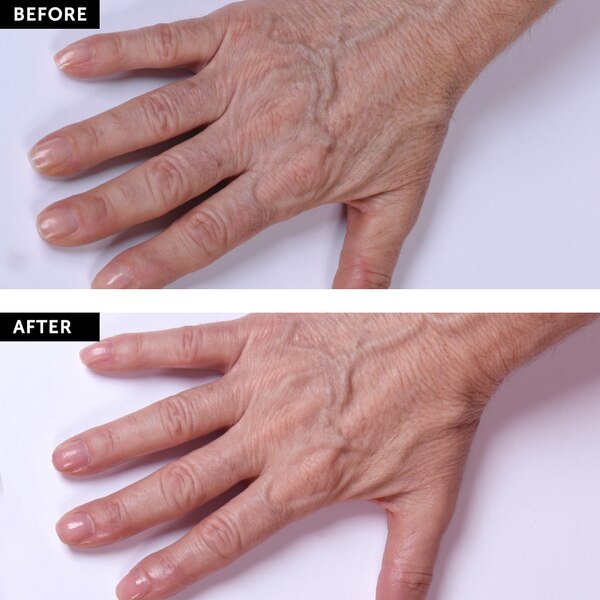SilcSkin Hand and Body Treatment