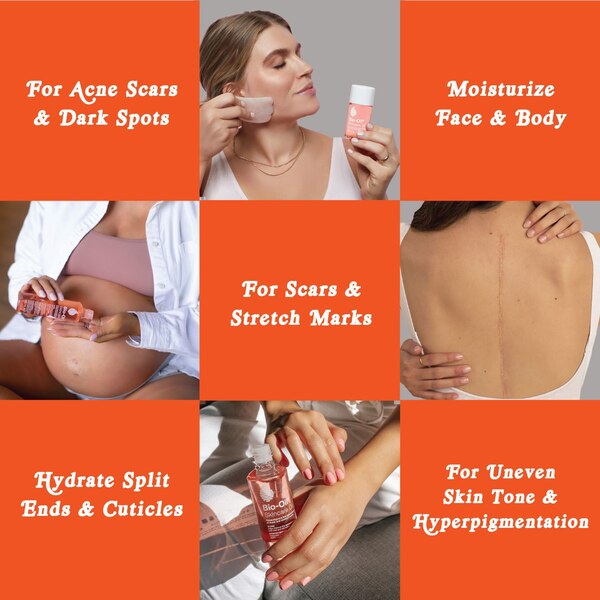 Bio-Oil Specialist Skin Care, 2 OZ