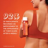 Bio Oil Skincare Oil, Original , thumbnail image