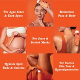 Bio Oil Skincare Oil, Original , thumbnail image