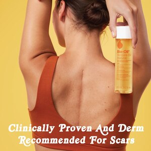 Bio Oil Natural, 0.85 OZ