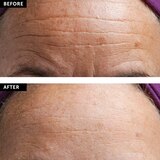SilcSkin Facial Pads – Brow set, thumbnail image