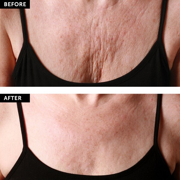 SilcSkin Decollette Pad