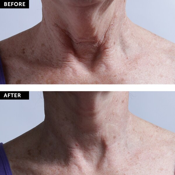 SilcSkin Collette Pad (neck)