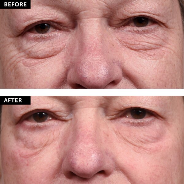 SilcSkin Eye Pads