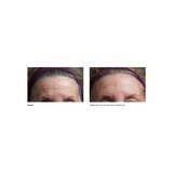 SilcSkin Full Face Set, thumbnail image 5 of 5
