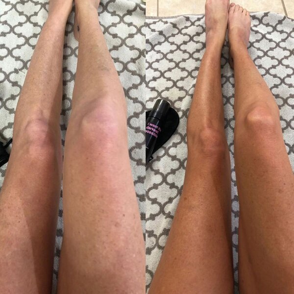 i want the darkest tan possible