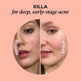 Zitsticka S.O.S. Zit Kit, thumbnail image